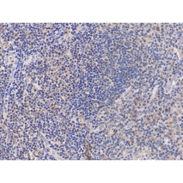 Cluster Of Differentiation 38 (CD38) Human Polyclonal Antibody