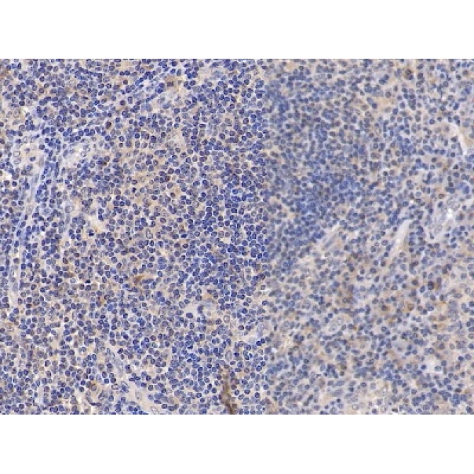 Cluster Of Differentiation 38 (CD38) Human Polyclonal Antibody
