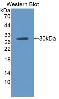 Cluster Of Differentiation 38 (CD38) Rat Polyclonal Antibody