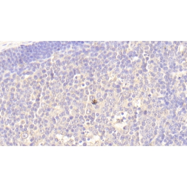 Toll Like Receptor 4 (TLR4) Human Polyclonal Antibody
