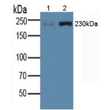 Myosin Heavy Chain 1 (MYH1) Human Polyclonal Antibody