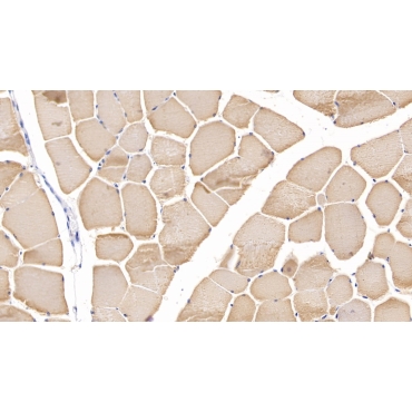 Myosin Heavy Chain 2 (MYH2) Human Polyclonal Antibody