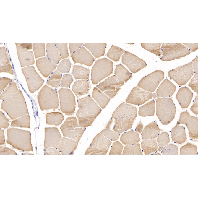 Myosin Heavy Chain 2 (MYH2) Human Polyclonal Antibody