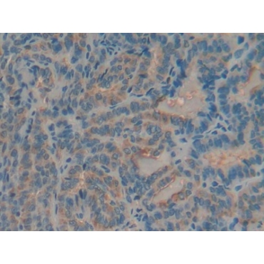 Mucin 5 Subtype AC (MUC5AC) Human Polyclonal Antibody