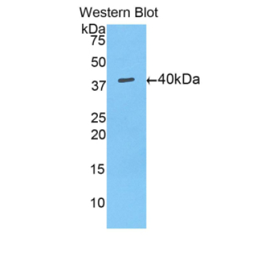 Mucin 5 Subtype AC (MUC5AC) Mouse Polyclonal Antibody