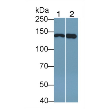 Epidermal Growth Factor Receptor (EGFR) Human Polyclonal Antibody