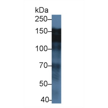 Epidermal Growth Factor Receptor (EGFR) Human Polyclonal Antibody