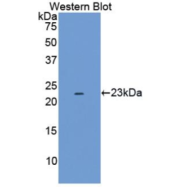 Epidermal Growth Factor Receptor (EGFR) Mouse Polyclonal Antibody