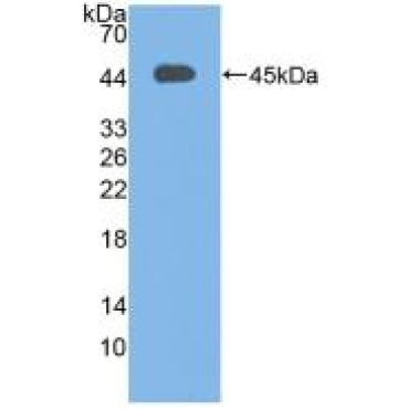 Complement C3 Convertase (C3 Convertase) Human Polyclonal Antibody
