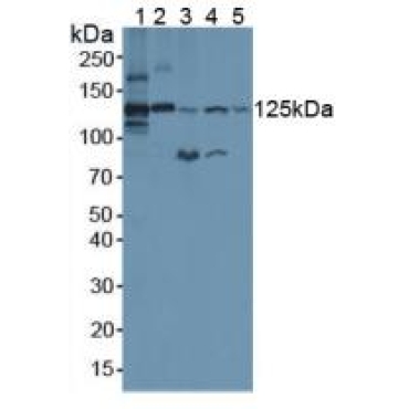 Complement C3 Convertase (C3 Convertase) Mouse Polyclonal Antibody