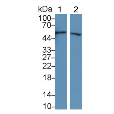 C4 Binding Protein Beta (C4BPb) Human Polyclonal Antibody