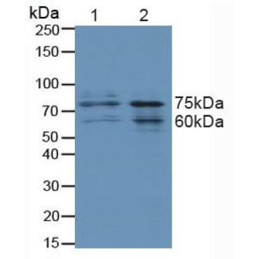 Forkhead Box Protein O3 (FOXO3) Human Polyclonal Antibody