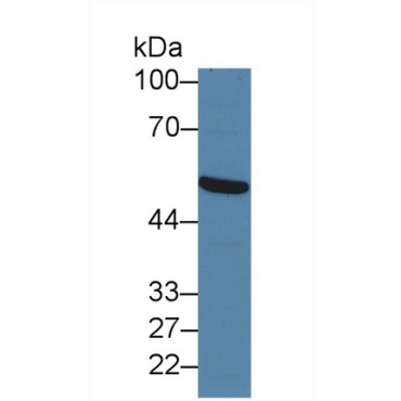 Forkhead Box Protein P1 (FOXP1) Human Polyclonal Antibody