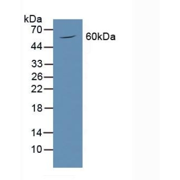 Podocalyxin (PODXL) Human Polyclonal Antibody
