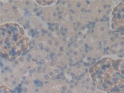 Podocalyxin (PODXL) Rat Polyclonal Antibody