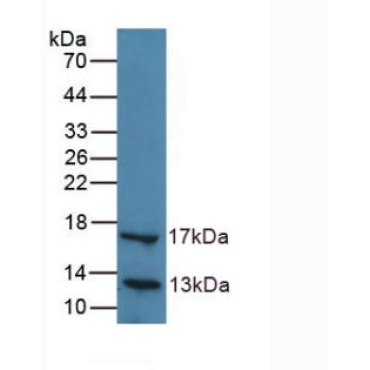 Lipase, Hepatic (LIPC) Human Polyclonal Antibody