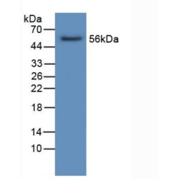 Lipase, Hepatic (LIPC) Human Polyclonal Antibody