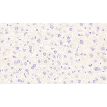 Lipase, Hepatic (LIPC) Mouse Polyclonal Antibody