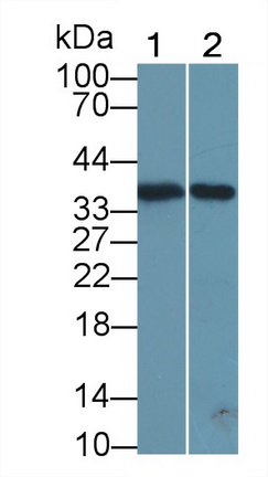 Chemokine C-X-C-Motif Ligand 16 (CXCL16) Human Polyclonal Antibody