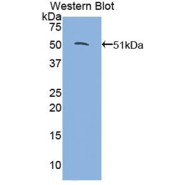 Glucocorticoid Receptor Alpha (GRa) Human Polyclonal Antibody
