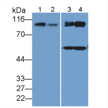 Hexokinase 1 (HK1) Human Polyclonal Antibody