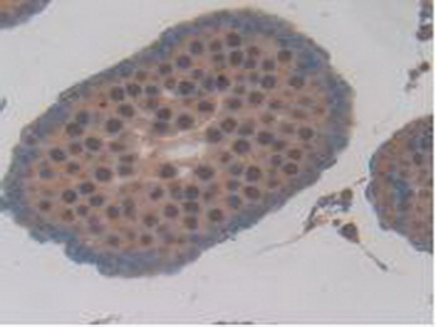 Hexokinase 1 (HK1) Rat Polyclonal Antibody