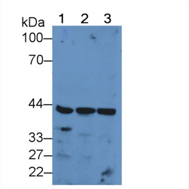 Pyruvate dehydrogenase alpha 1 (PDHA1) Human Polyclonal Antibody
