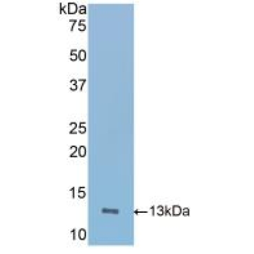 Inducible T-Cell Co Stimulator (ICOS) Mouse Polyclonal Antibody