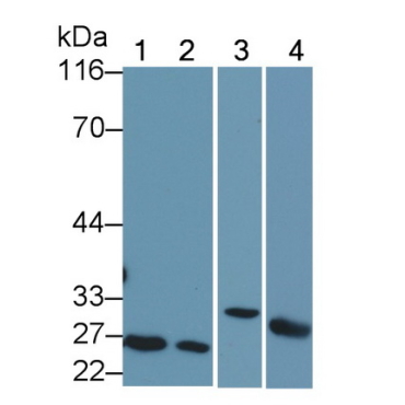 B-Cell Leukemia/Lymphoma 2 (Bcl2) Human Polyclonal Antibody