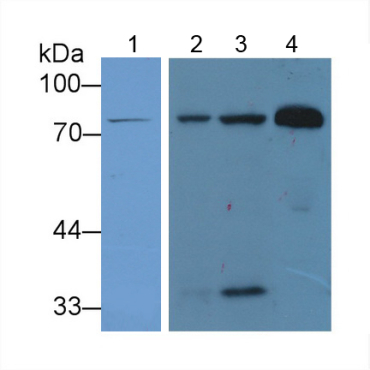 Lactoferrin (LTF) Human Polyclonal Antibody