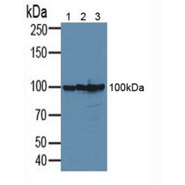 Cluster Of Differentiation 276 (CD276) Human Polyclonal Antibody