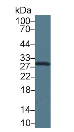 Carbonic Anhydrase II (CA2) Mouse Polyclonal Antibody