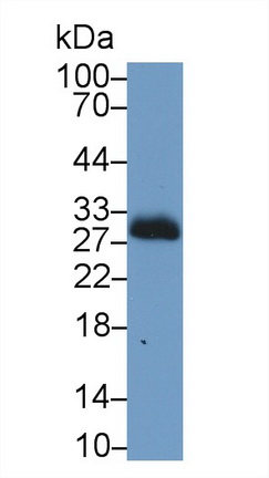Carbonic Anhydrase II (CA2) Rabbit Polyclonal Antibody