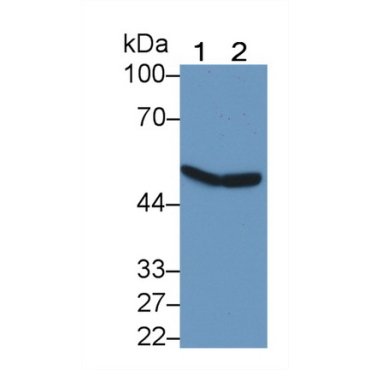 Complement Factor P (CFP) Human Polyclonal Antibody