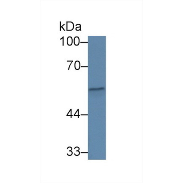 Complement Factor P (CFP) Human Polyclonal Antibody