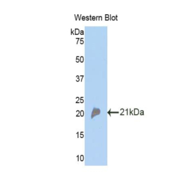 Complement Factor P (CFP) Mouse Polyclonal Antibody