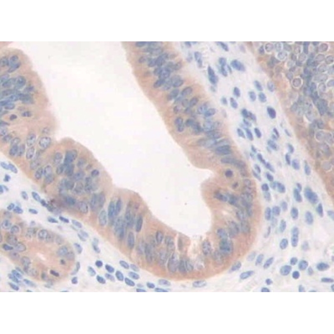 Complement Factor P (CFP) Mouse Polyclonal Antibody