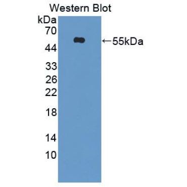 Kidney Injury Molecule 1 (Kim1) Human Polyclonal Antibody
