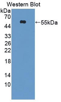 Kidney Injury Molecule 1 (Kim1) Human Polyclonal Antibody