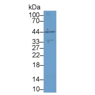 Kidney Injury Molecule 1 (Kim1) Human Polyclonal Antibody