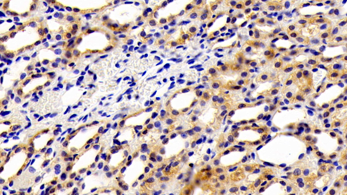 Kidney Injury Molecule 1 (Kim1) Rat Polyclonal Antibody