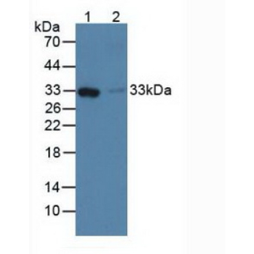 Ficolin 1 (FCN1) Human Polyclonal Antibody