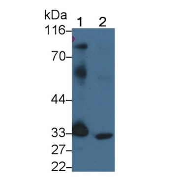 Programmed Cell Death Protein 1 Ligand 1 (PDL1) Human Polyclonal Antibody