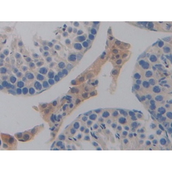 Programmed Cell Death Protein 1 Ligand 1 (PDL1) Mouse Polyclonal Antibody