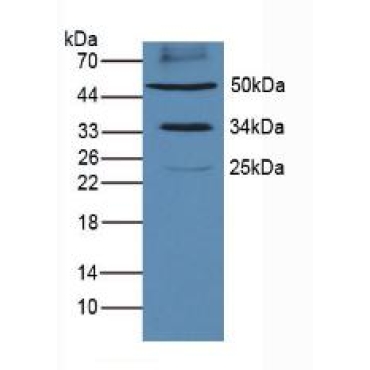Programmed Cell Death Protein 1 Ligand 1 (PDL1) Mouse Polyclonal Antibody