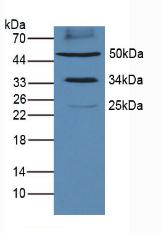 Programmed Cell Death Protein 1 Ligand 1 (PDL1) Mouse Polyclonal Antibody