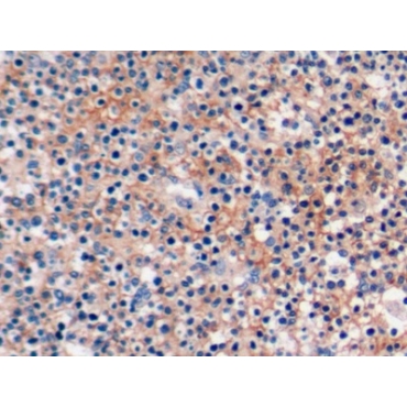Programmed Cell Death Protein 1 Ligand 2 (PDL2) Human Polyclonal Antibody