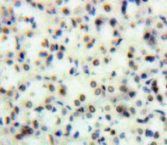 Topoisomerase II (TOP2) Mouse Polyclonal Antibody
