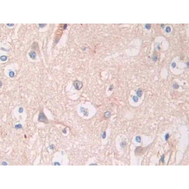 Angiotensinogen (AGT) Human Polyclonal Antibody
