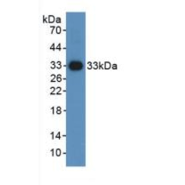 Hypoxia Inducible Factor 1 Alpha (HIF1a) Mouse Polyclonal Antibody